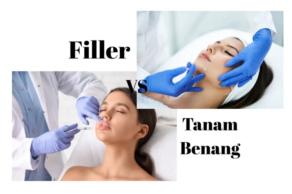 Filler vs tanam benang